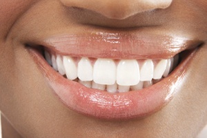 Closeup of straight, white, beautiful smile