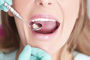 Closeup of patient during dental care