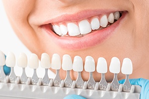 Closeup of teeth compared to tooth shade chart