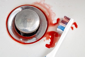 Blood on a toothbrush