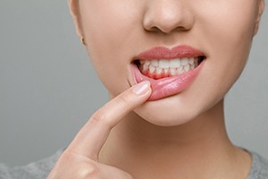 A young woman revealing her inflamed gums