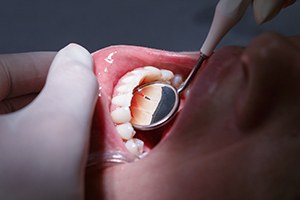 Closeup of smile with healthy teeth and gums