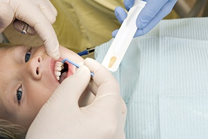 Child receiving fluoride treatment