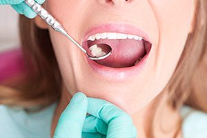 Closeup of patient receiving dental exam