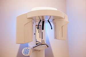 3D cone beam scanner